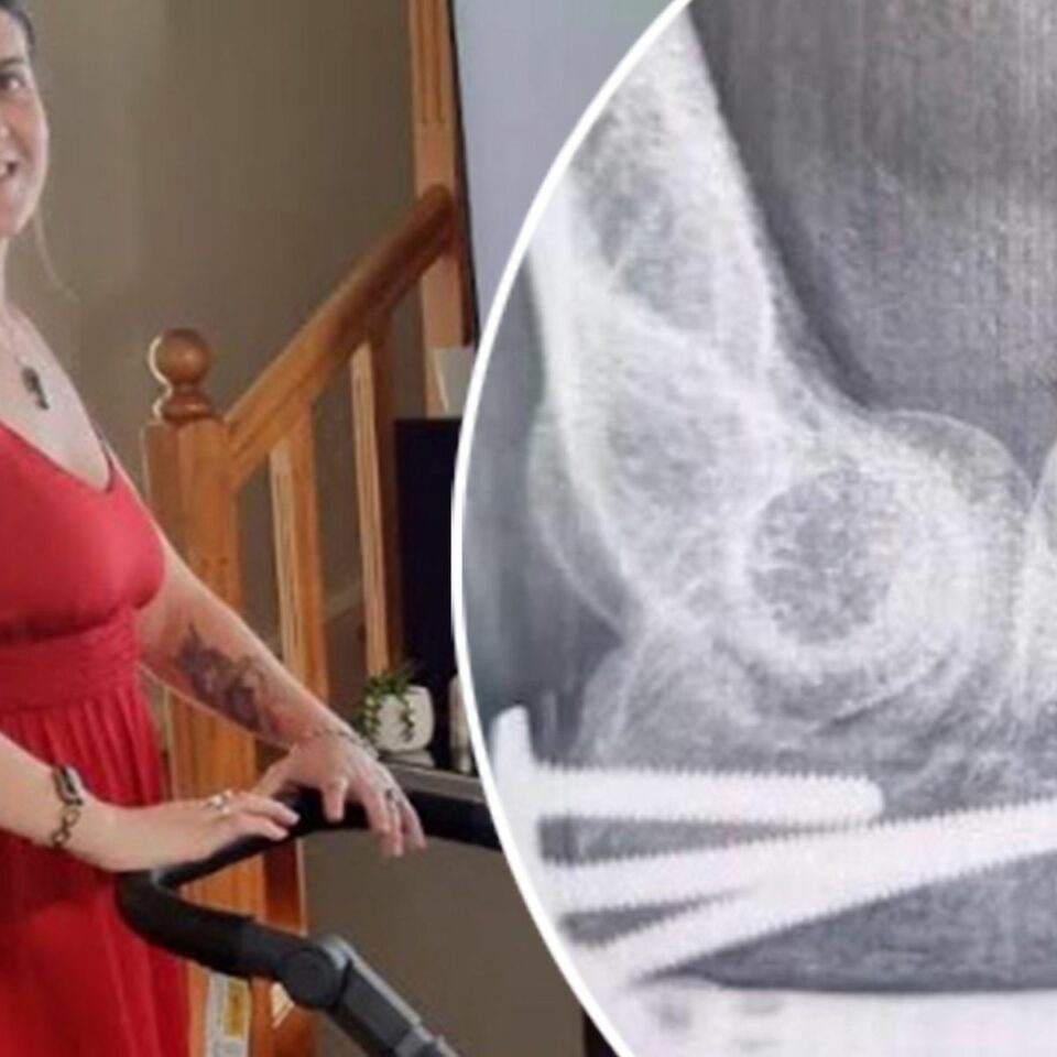 Pregnant woman hurt in e-bike crash