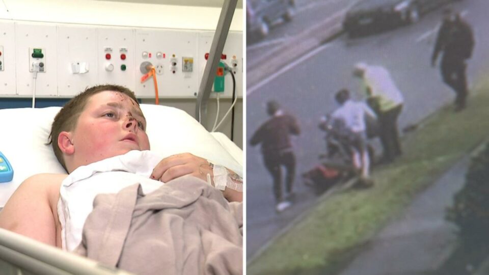 Four year old Aussie boy injured in alleged hit and run