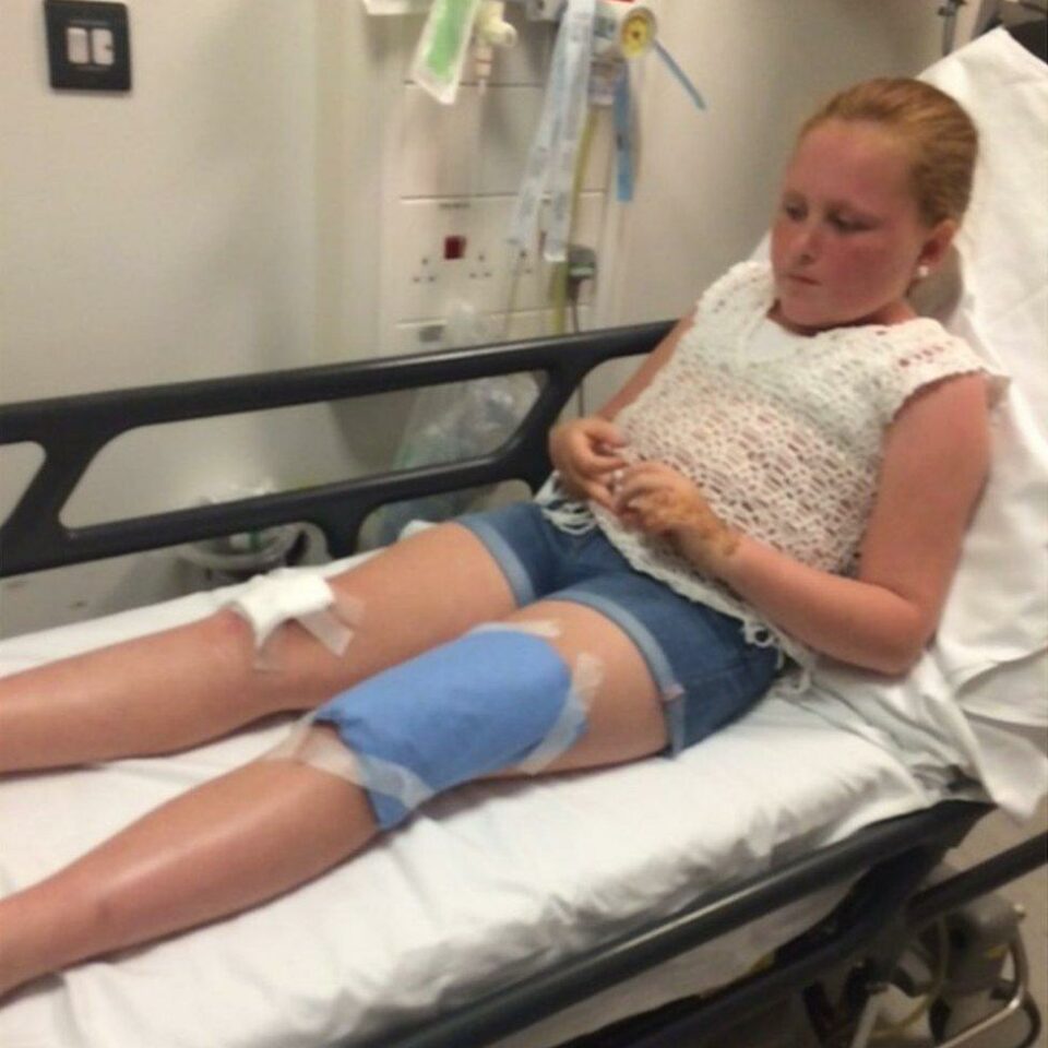 Girl in hospital after alleged hit-and-run
