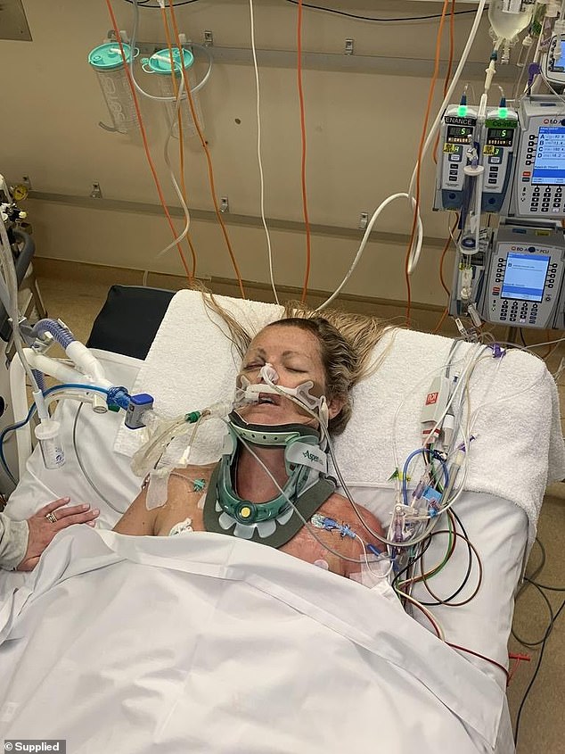 Brave 4yo fights for life after horror Bali accident